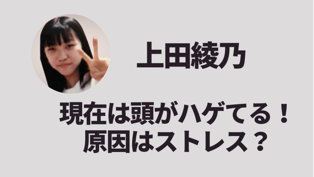 【顔画像】上田綾乃の頭がハゲてる！原因は逮捕のストレスで円形脱毛症？